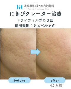 症例7