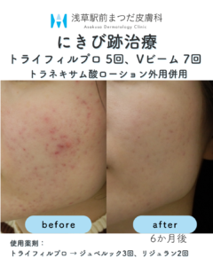 症例6
