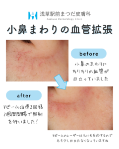 症例2
