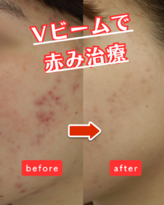 症例8
