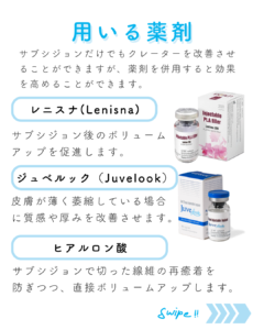 サブシジョンとは