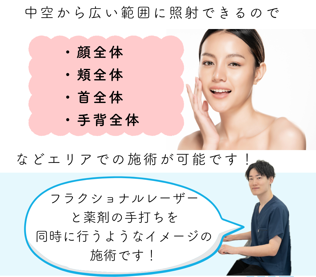 キュアジェットフラクショナル
