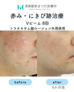 症例13
