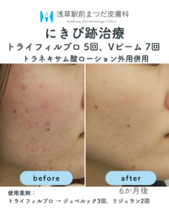 症例9