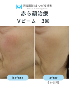 症例11