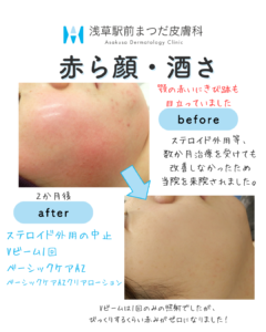 症例12