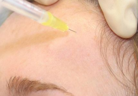 しわ改善注射とは